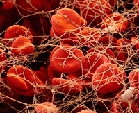 Тромбоциты при беременности — причины отклонений от нормы Тромбоциты при беременности — причины отклонений от нормы