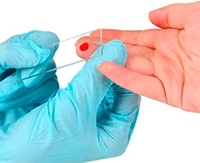 Лейкоциты в крови при беременности: причины нарушения нормы Лейкоциты в крови при беременности: причины нарушения нормы