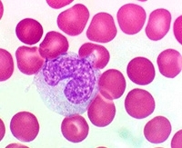 Причины повышения и понижения моноцитов в крови у взрослого Причины повышения и понижения моноцитов в крови у взрослого