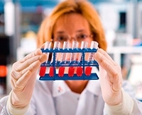 Низкий уровень общего билирубина в крови: причины понижения показателя Низкий уровень общего билирубина в крови: причины понижения показателя