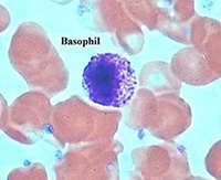Что делать при повышении уровня базофилов и что это может означать? Что делать при повышении уровня базофилов и что это может означать?
