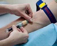 Система гемостаза: зачем сдавать анализ на свёртываемость крови Система гемостаза: зачем сдавать анализ на свёртываемость крови