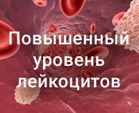 Повышенное содержание лейкоцитов в крови: причины, клиническая картина, принципы лечения Повышенное содержание лейкоцитов в крови: причины, клиническая картина, принципы лечения